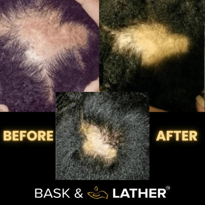 Scalp Stimulator Hair Growth Oil (2 fl oz)