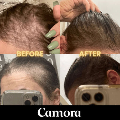 Scalp Stimulator Hair Growth Oil (2 fl oz)