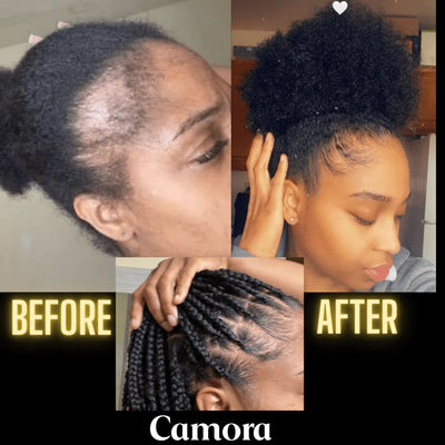 Scalp Stimulator Hair Growth Oil (2 fl oz)