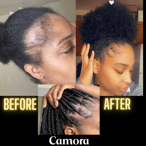 Scalp Stimulator Hair Growth Oil (2 fl oz)