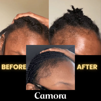 Scalp Stimulator Hair Growth Oil (2 fl oz)